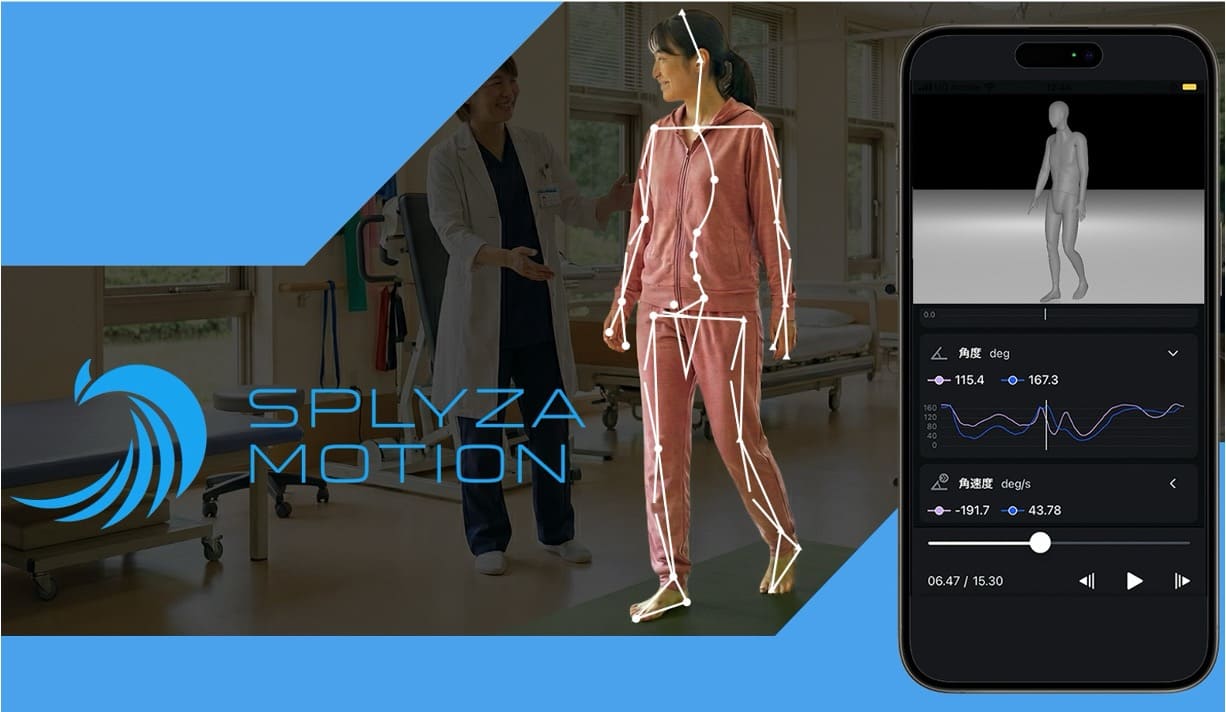 【医療・ヘルスケア・製造業向け】AI動作解析「SPLYZA Motion」による事例や技術の紹介